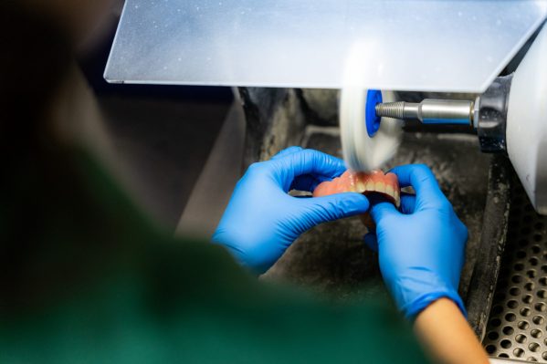 Breuk gebroken scheurtje reparatie prothese kunstgebit